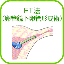 FT法