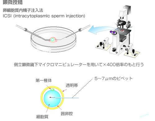 顕微授精図