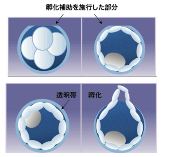 孵化補助