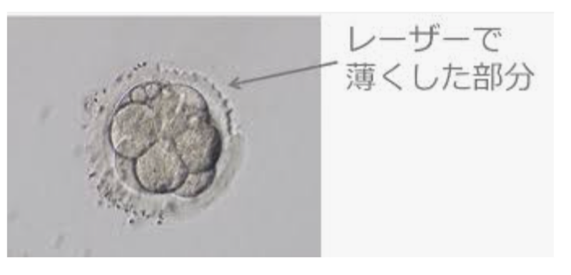 レーザーで薄くした部分