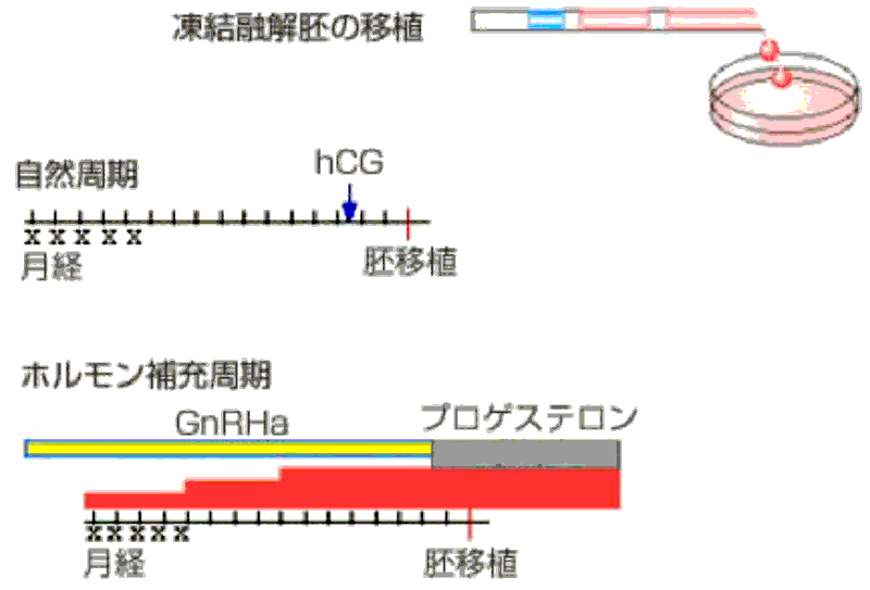 凍結融解胚の移植